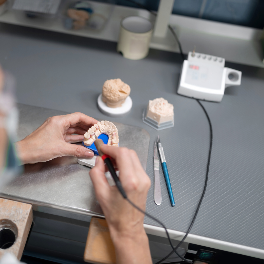 A dental technician working create customised veneers. Emax porcelain veneers packages  in Vietnam are much more affordable than in Melbourne, Sydney, Perth, or Brisbane, Australia. Emax veneers are more premium than traditional veneer. They look translucent and mimic the colour of natural teeth. Glamjet offers 6 veneer, 10 veneer, 16 veneer packages in Vietnam, Thailand, and South Korea with payment plans. Price of porcelain veneers are 70% cheaper than Australia.