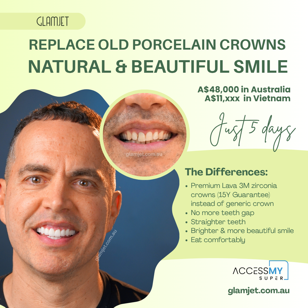 executive’s smile makeover with Lava 3M zirconia crowns in Hanoi via Glamjet.com.au saved $40,000 vs local dental costs in Perth, Australia and paid with Super.