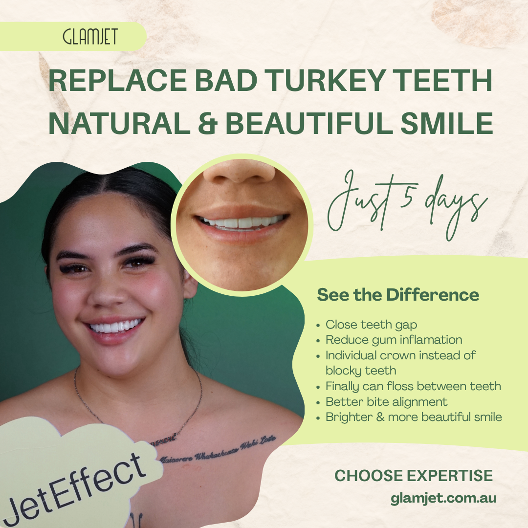Before and after smile transformation of a Melbourne client who replaced uneven, inflamed ‘Turkey teeth’ with natural-looking veneers at a leading dental clinic in Vietnam through Glamjet.com.au. Not all dental tourism is equal. Book trusted, high-quality dentists with Glamjet.com.au for safe, beautiful results.