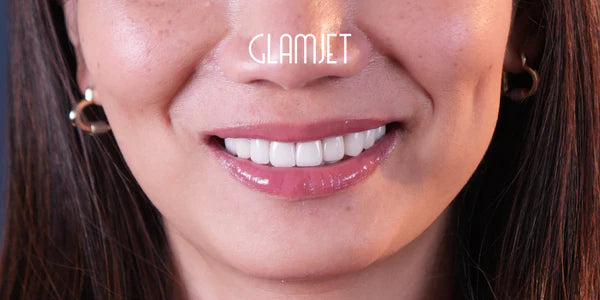 Smile Reveal