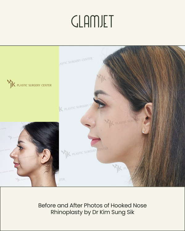 Surgery Enhancements