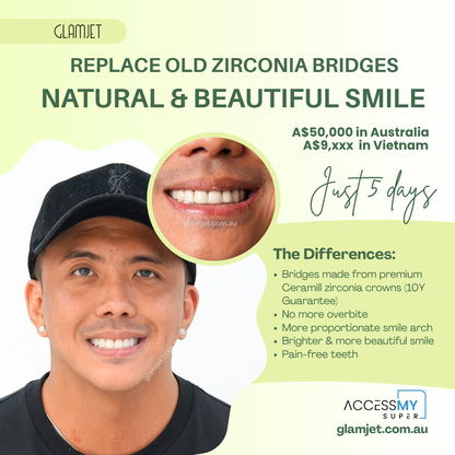Before and after smile makeover of a male nurse from the Philippines who replaced bulky, inflamed dental bridges that caused an overbite. After comparing prices in Vietnam, Australia, and the Philippines, he chose Glamjet.com.au for affordable, high-quality zirconia crowns and fixed bridges in Vietnam. He now feels confident and handsome with his new smile.