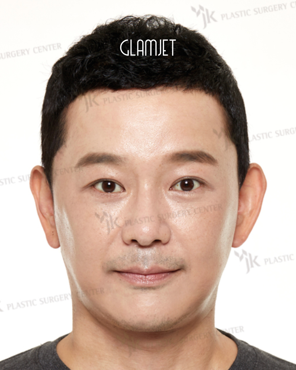 Look Youthful And Fresh