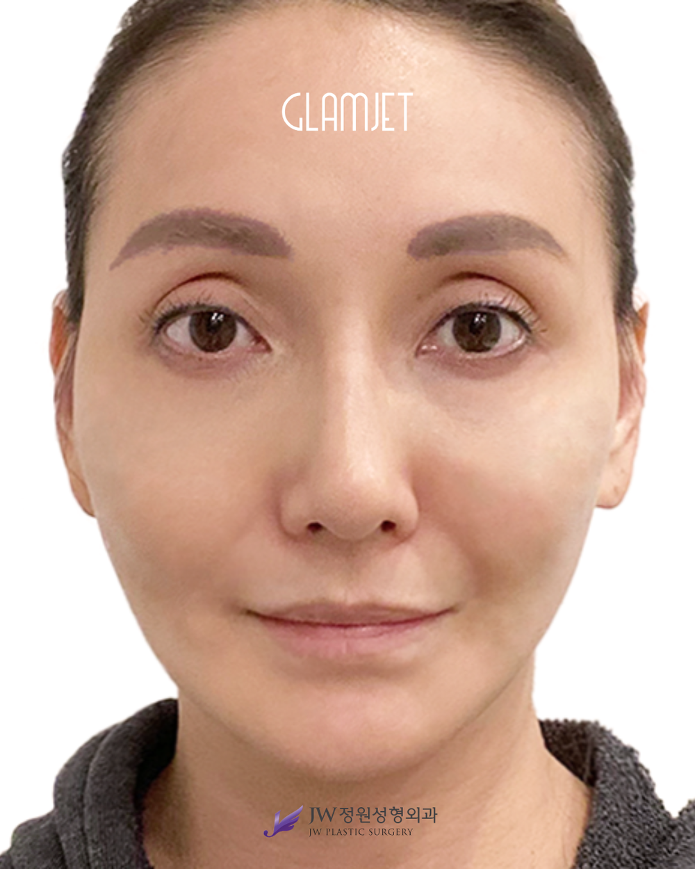 Look Youthful And Fresh