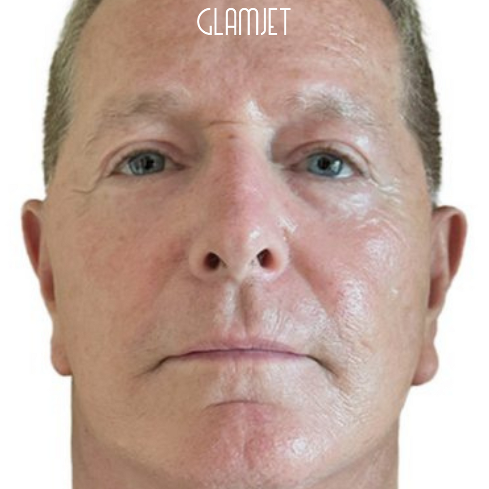 Look Youthful And Fresh