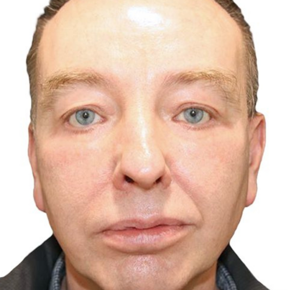 Look Youthful And Fresh