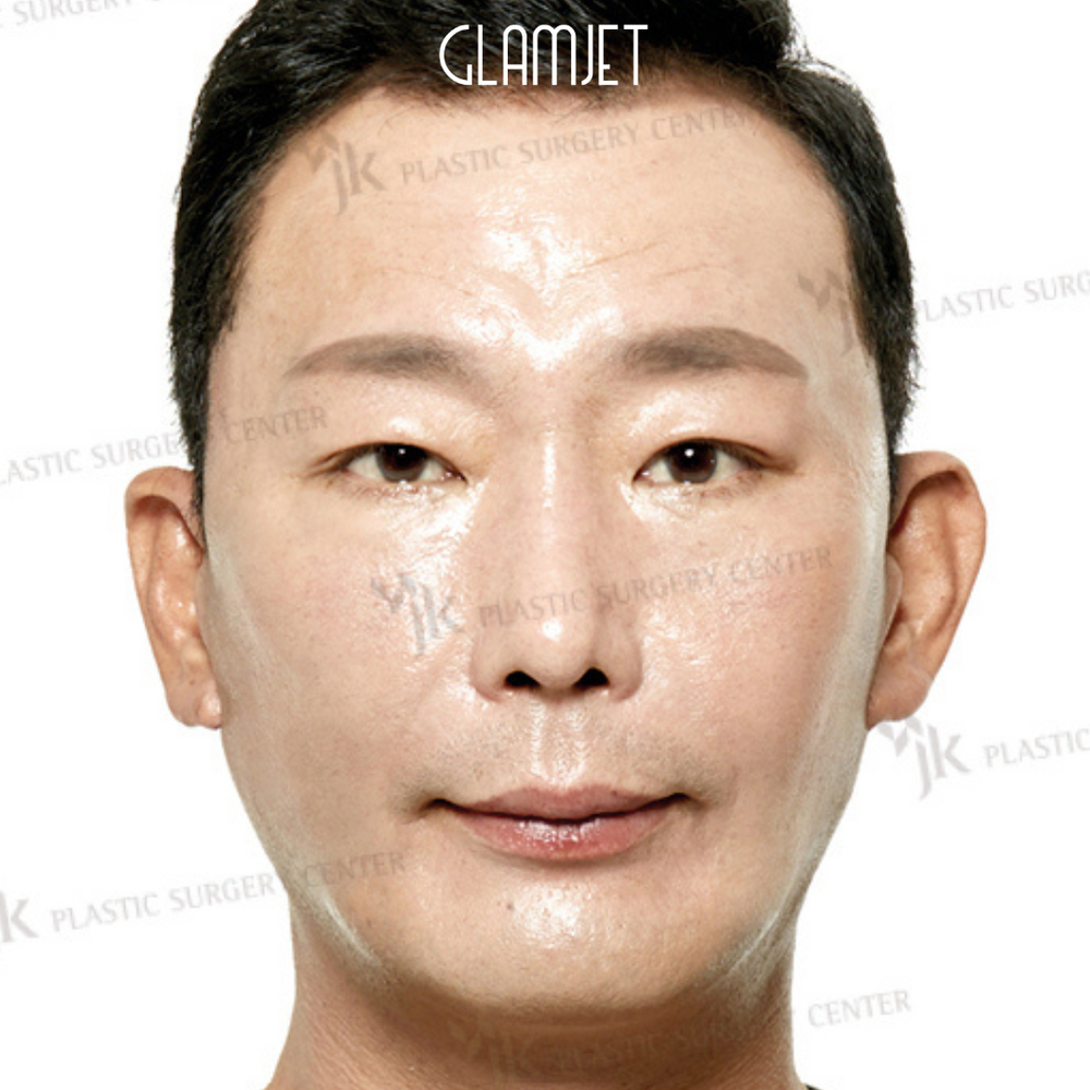 Look Youthful And Fresh