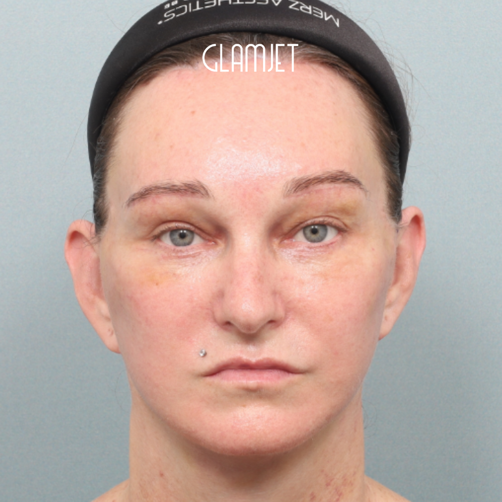 Look Youthful And Fresh