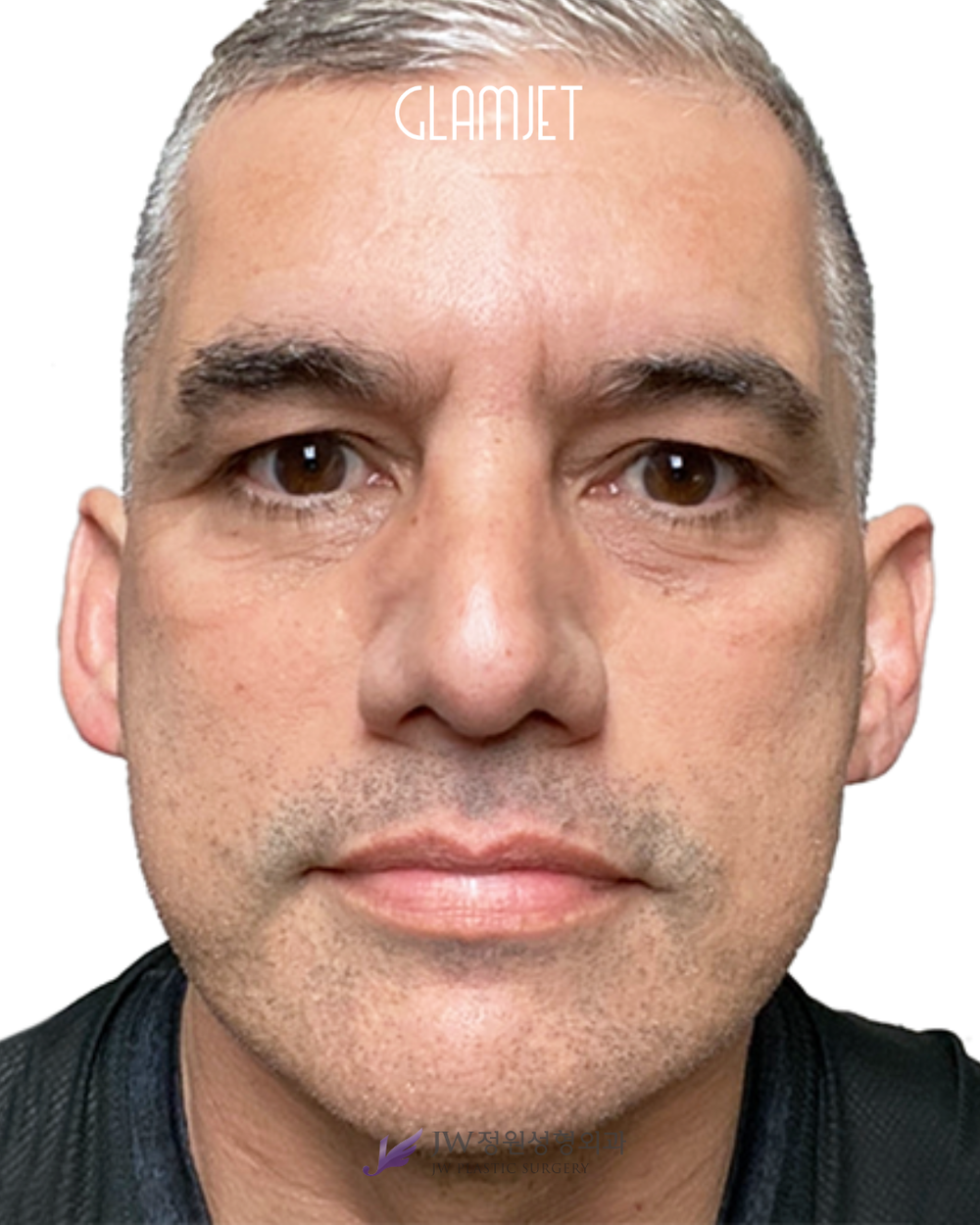 The Nose You've Always Wanted When You've Done Waiting