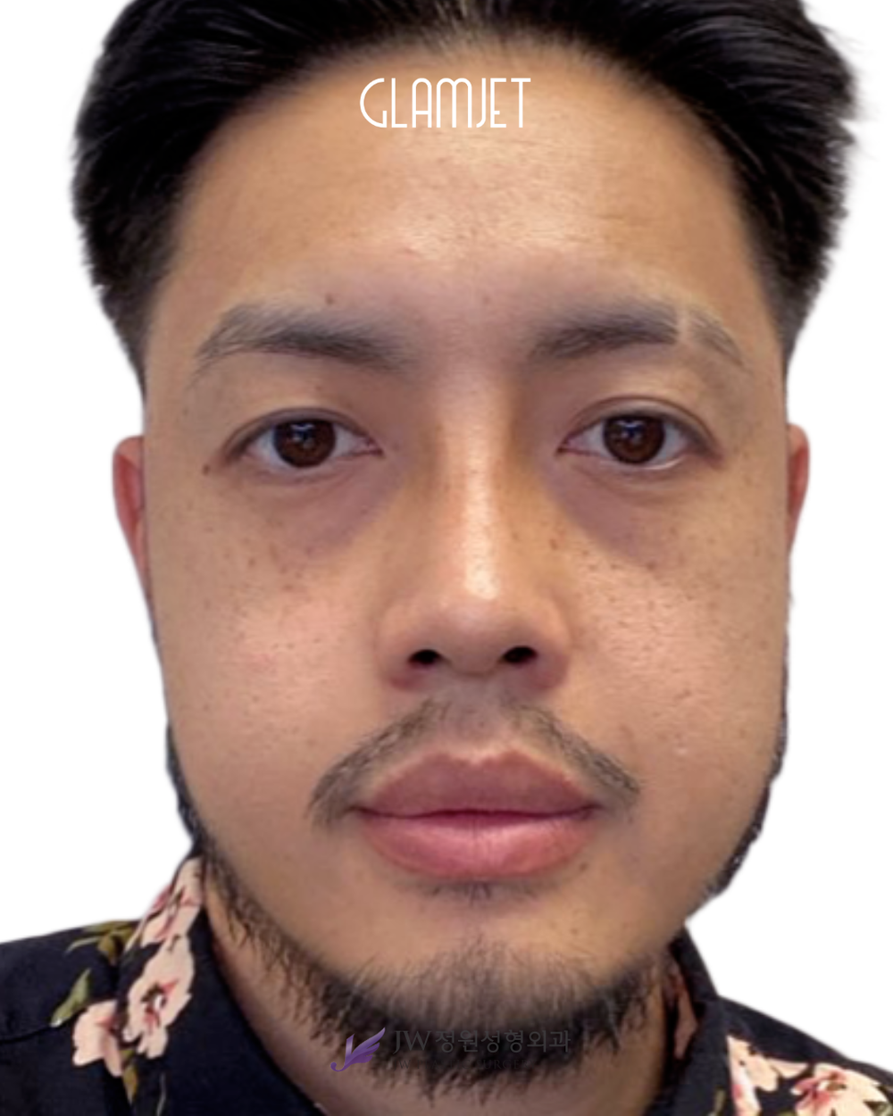 The Nose You've Always Wanted When You've Done Waiting