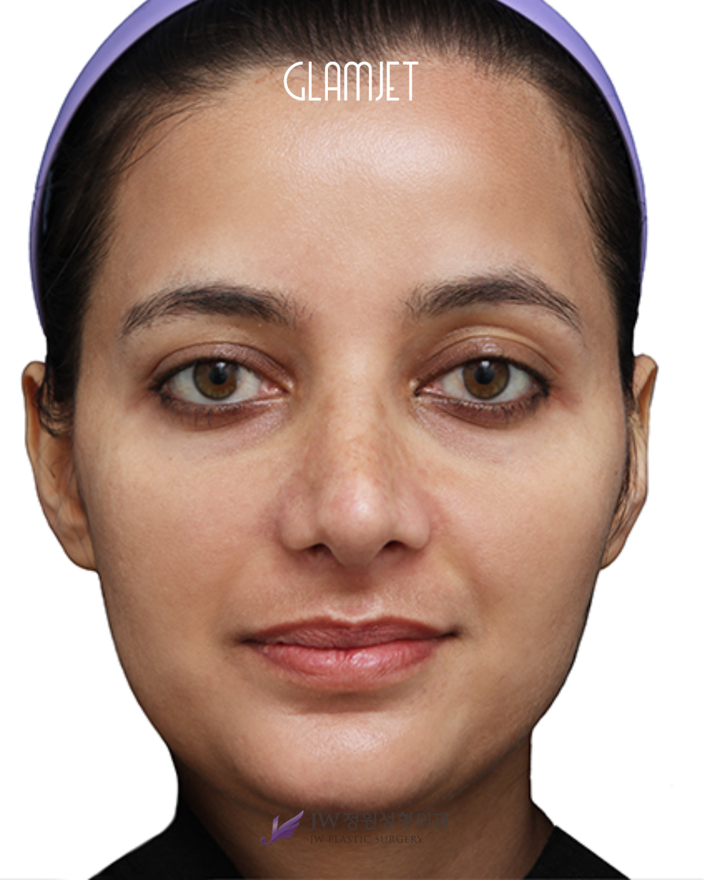 The Nose You've Always Wanted When You've Done Waiting