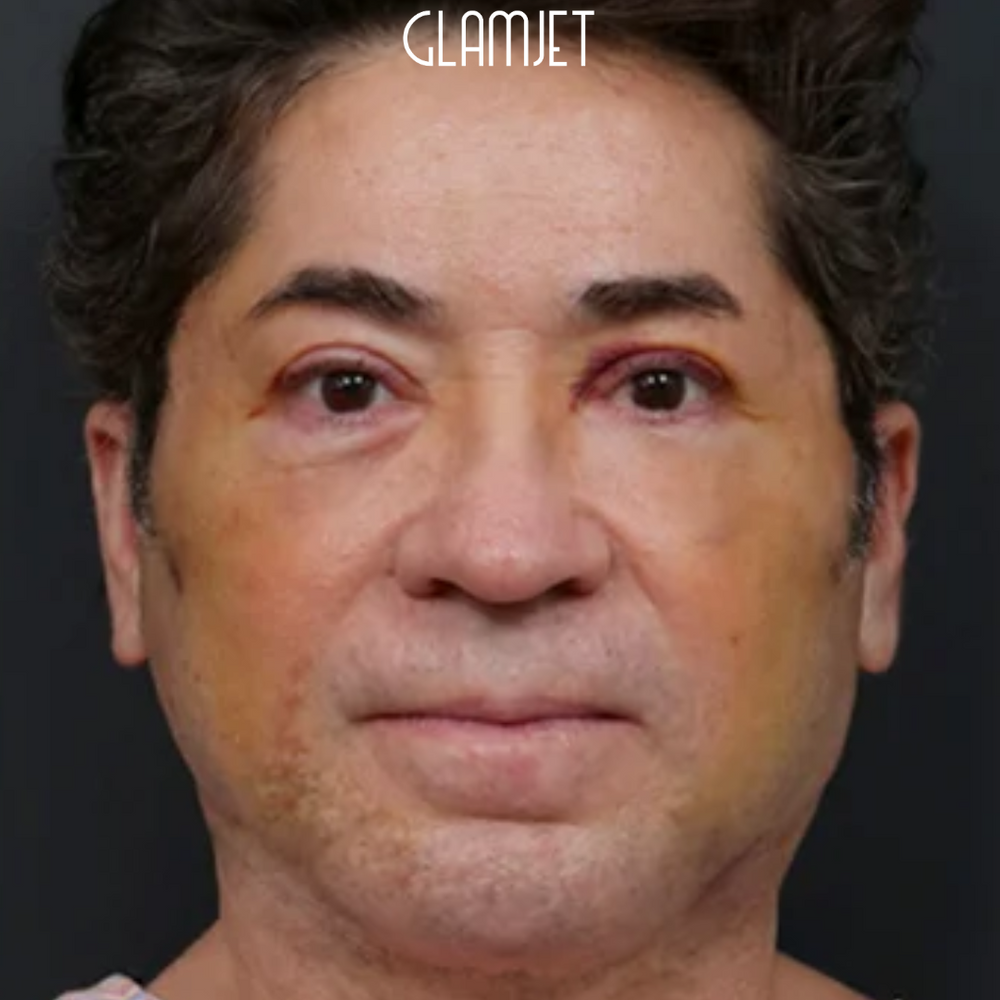 Look Youthful And Fresh