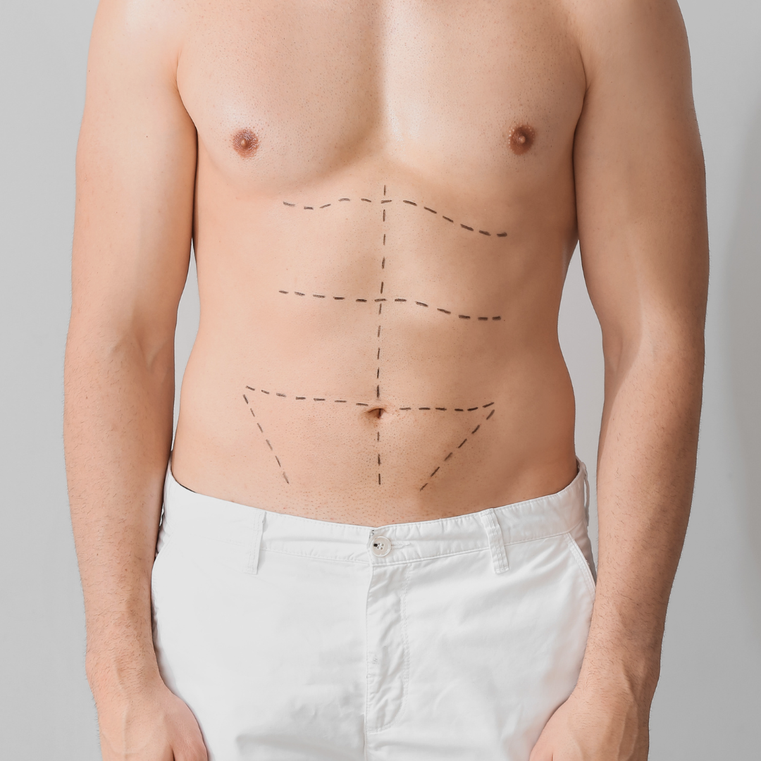 Men Flat Abs Makeover Packages in South Korea