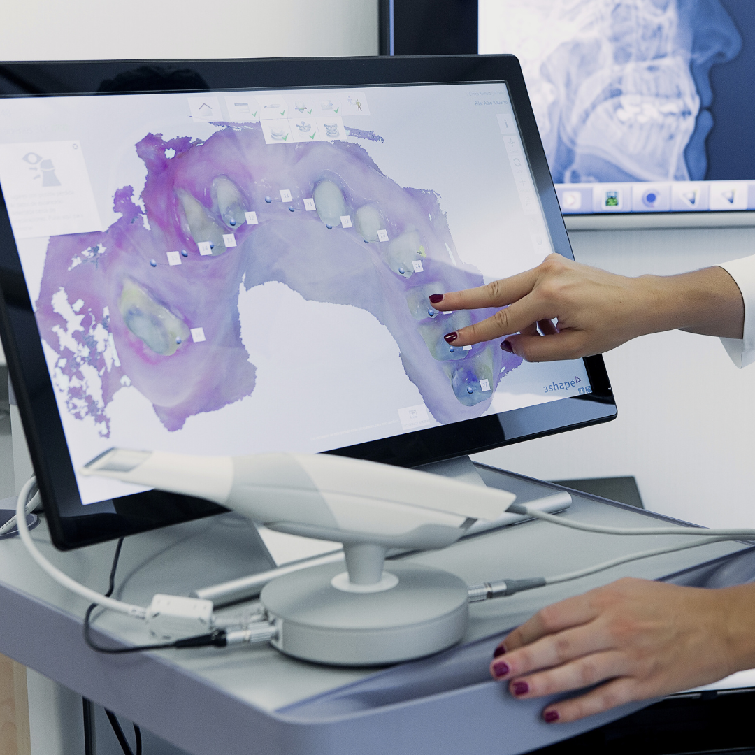 Dentist asses 3D scan of teeth before dental restoration  at a dental clinic in Ho Chi Minh city, Vietnam. Dentist will assess suitability for all-on-4 implants. Glamjet works with expert dentists in Ho Chi Minh city in Vietnam. The cost for all-on-4 implants in Ho Chi Minh city, Vietnam is 70%-80% cheaper than in the USA, Australia, and the UK. Glamjet is an Australian company help travellers arrange dental holidays with ease