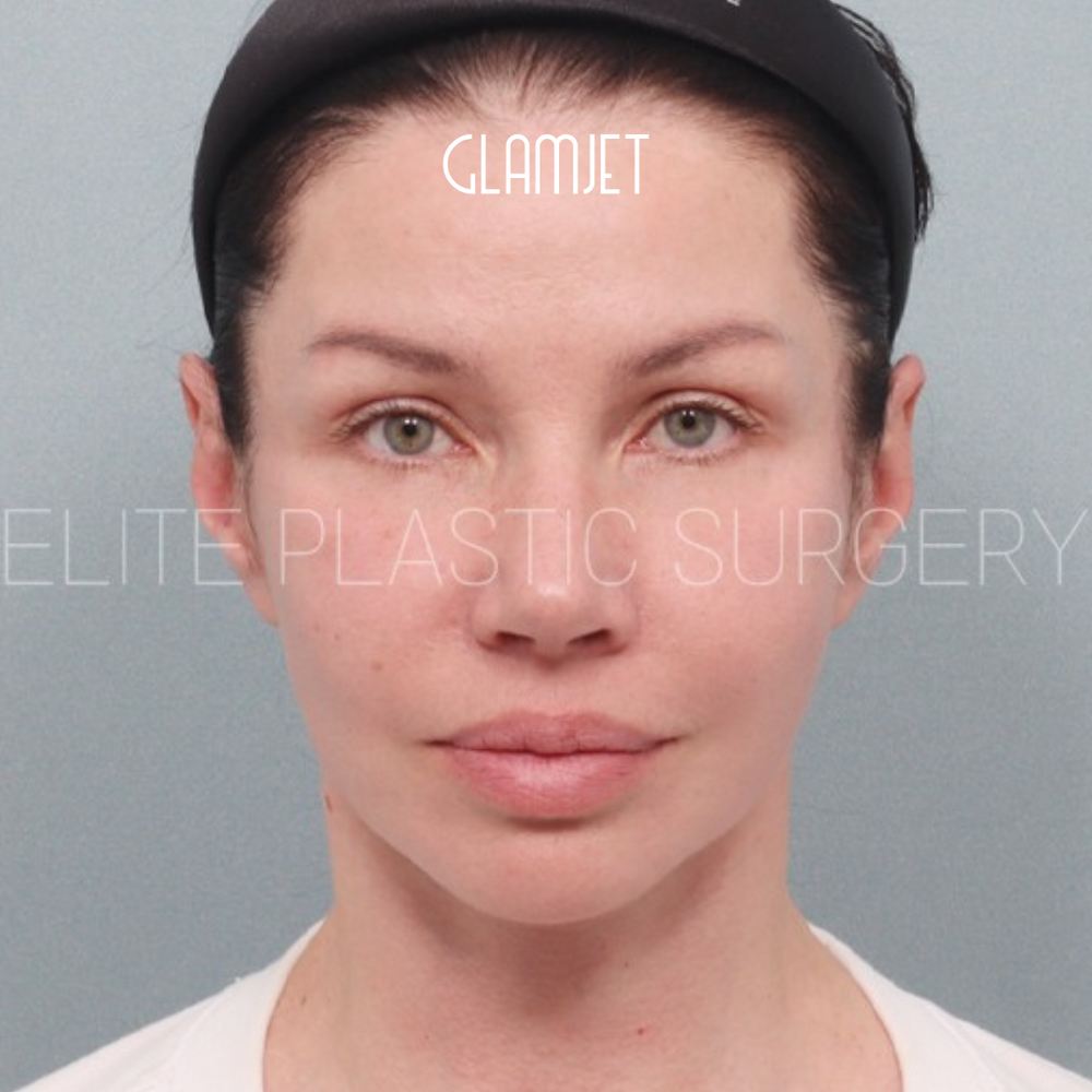 Look Youthful And Fresh