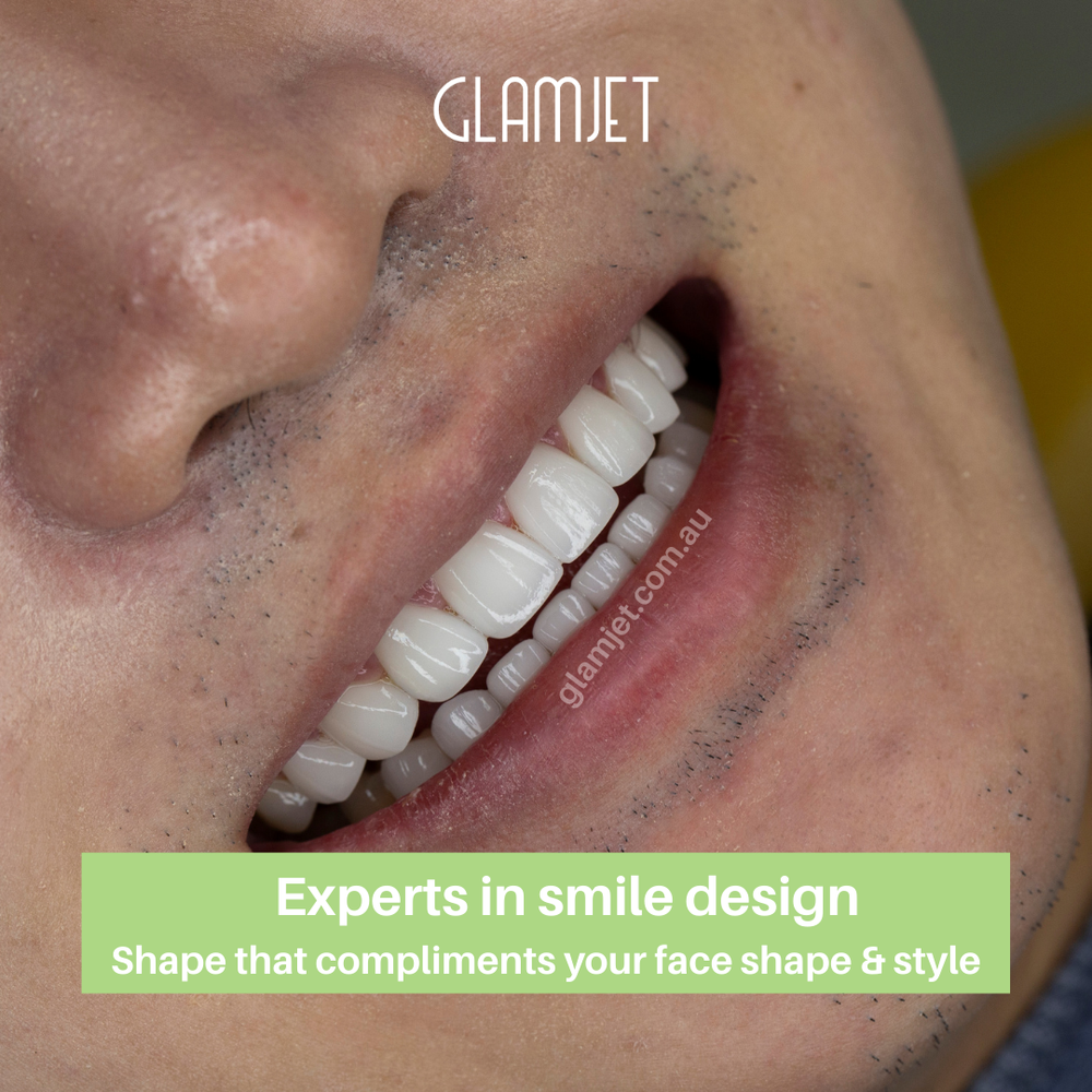 Your Dream Smile. 70% Less Than Australia